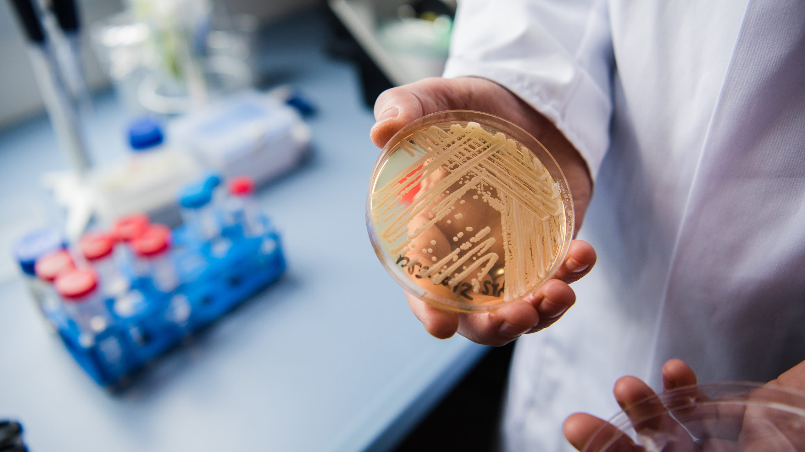 New study reveals why dangerous fungus is so difficult to treat — KTVU FOX 2 Bay Area, San Mateo Community news